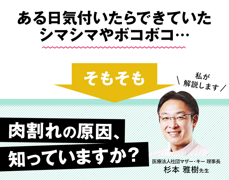 そもそも肉割れの原因、知っていますか？