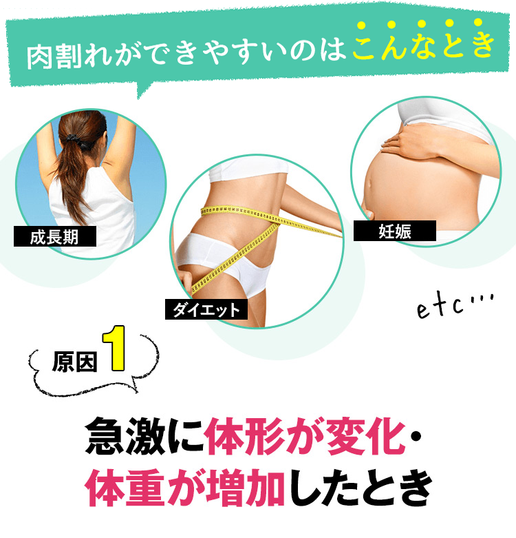 原因１：急激に体形が変化・体重が増加したとき