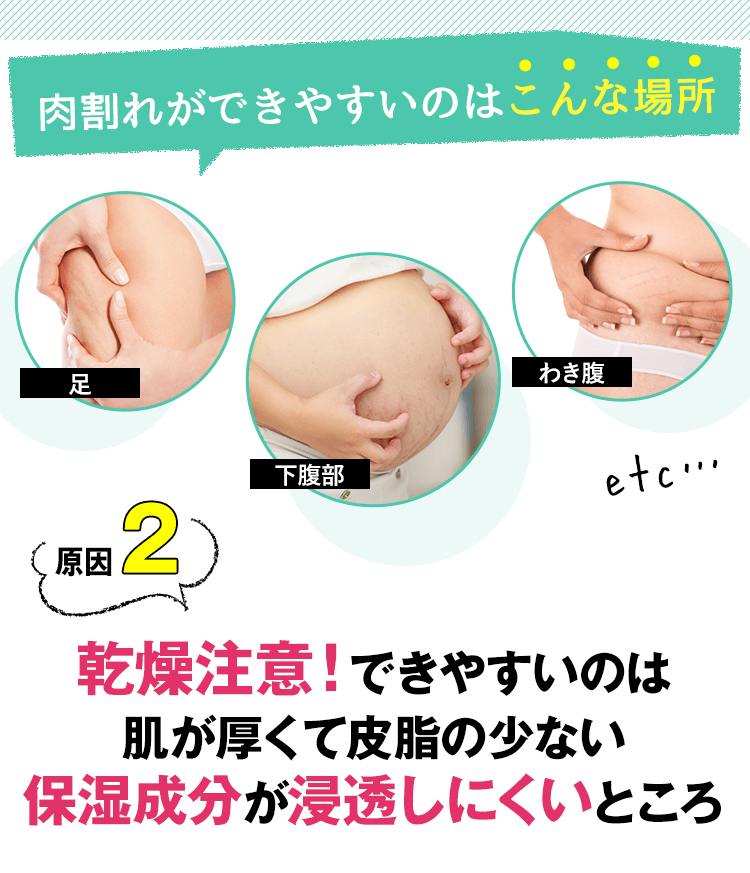 原因２：乾燥注意！できやすいのは肌が厚くて皮脂の少ない保湿成分が浸透しにくいところ