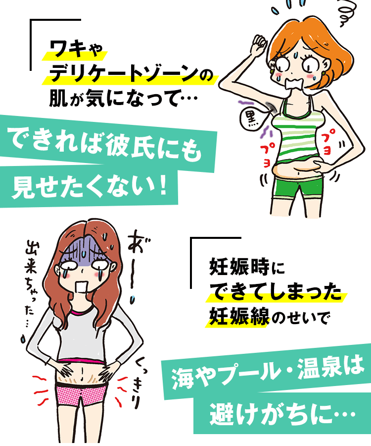 ワキやデリケートゾーンの肌が気になる！妊娠線のせいで海やプール・温泉は避けがち