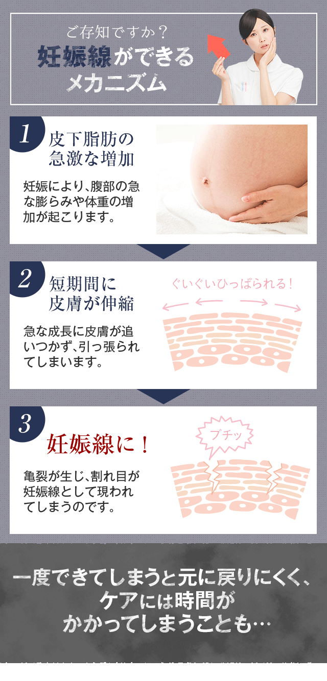 [ご存知ですか？妊娠線ができるメカニズム] 1.皮下脂肪の急激な増加 2.短期間に皮膚が伸縮 3.妊娠線に！ 一度できてしまうと元に戻りにくく、ケアには時間がかかってしまうことも…