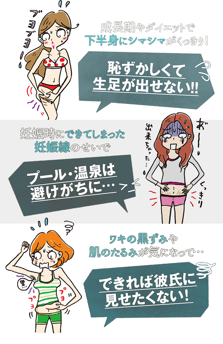 成長期やダイエットで 下半身にシマシマがくっきり！恥ずかしくて 生足が出せない!! 妊娠時にできてしまった 妊娠線のせいでプール・温泉は 避けがちに… ワキの黒ずみや   肌のたるみが気になって…できれば彼氏に 見せたくない！