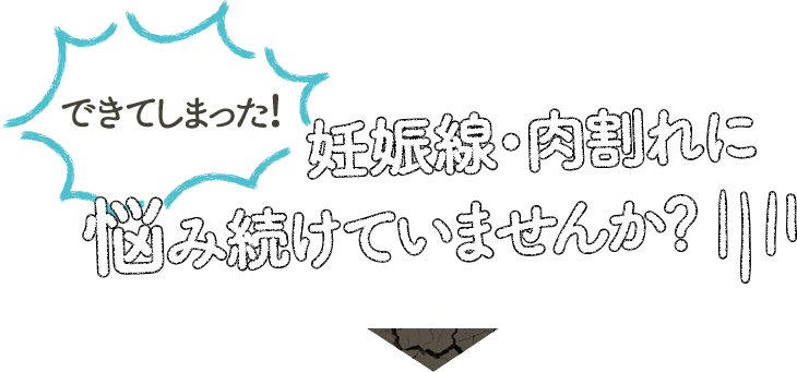できてしまった！妊娠線・肉割れに 悩み続けていませんか？