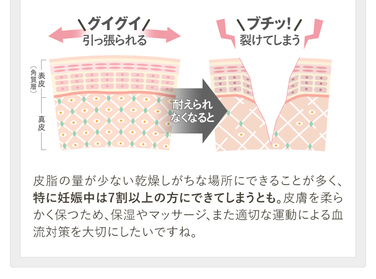 グイグイ 引っ張られる ブチッ！ 裂けてしまう